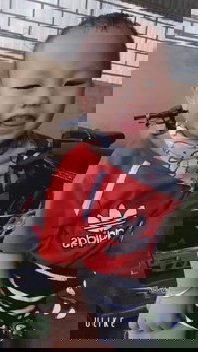 Đang bầu 36w4d mà mọc răng khôn có làm sao k các mom ơi