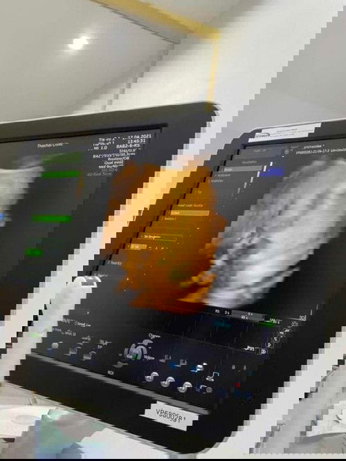 ขอดูภาพ 4 มิติ ของลูกๆ ทีม พ.ค.หน่อยค่ะ