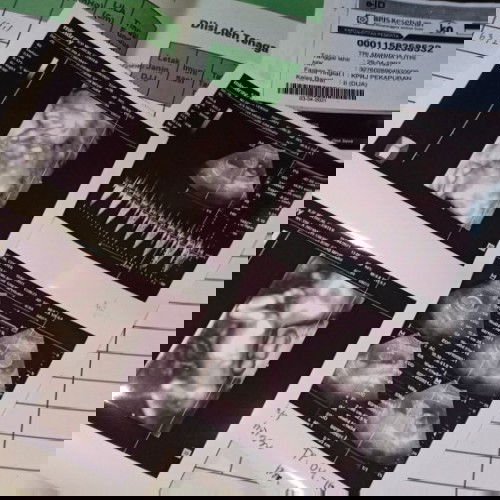 16week perut bawah sakit