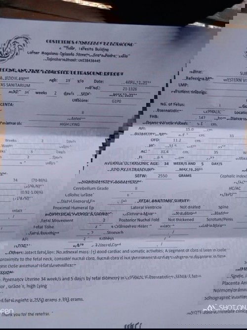 Share & ask po ako sa inyo. Hehe