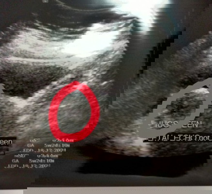 Ragu2 samaada pregant@tak