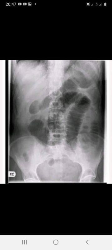 Peringatan penting buat emak2