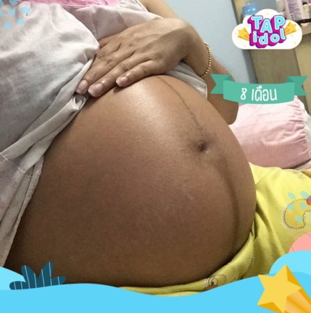 ทุกคนว่าท้องเราจะเป็นผญหรือผชคะ ตอน4เดือนหมอซาวบอกว่าเป็นผญ แต่มีคนทักว่าท้องเราเหมือนจะได้ผช