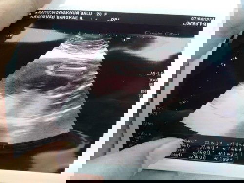 น้องผญ.หรือป่าวคะ