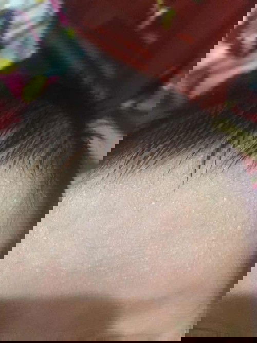 Cara menghilangkan bruntusan pada kulit wajah bayi