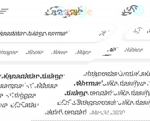 Osteoporosis di usia muda