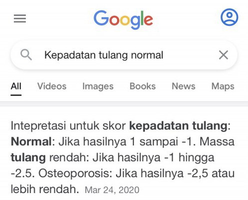 Osteoporosis di usia muda