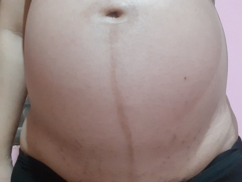 33+2 เริ่มแตกแล้ว