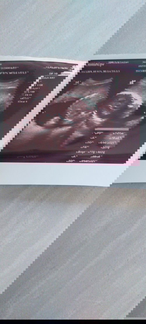 Lebaran dirumah aja sambil menunggu launching baby kedua diBulan yang Fitri