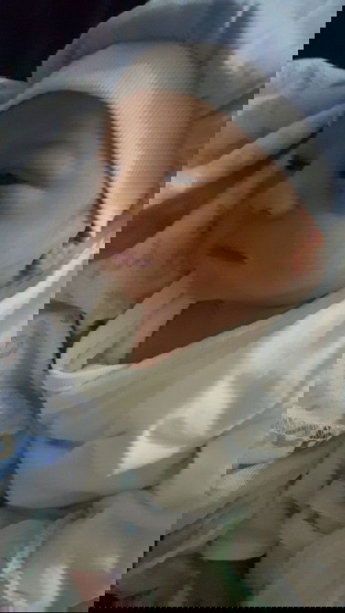 Abruption of Placenta baby