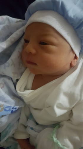 Abruption of Placenta baby