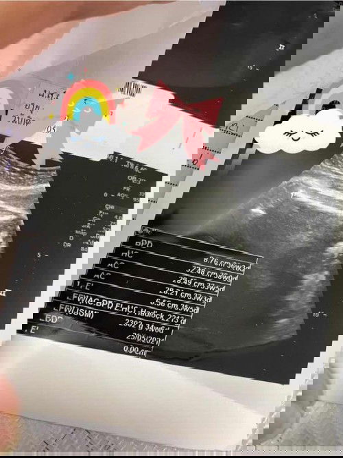 Week35 ก่อนพบกันอีก 1 เดือน