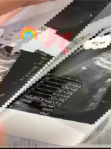 Week35 ก่อนพบกันอีก 1 เดือน