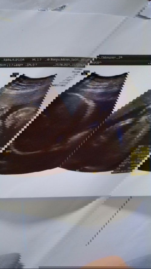 Sharing Lahiran yuk bun..