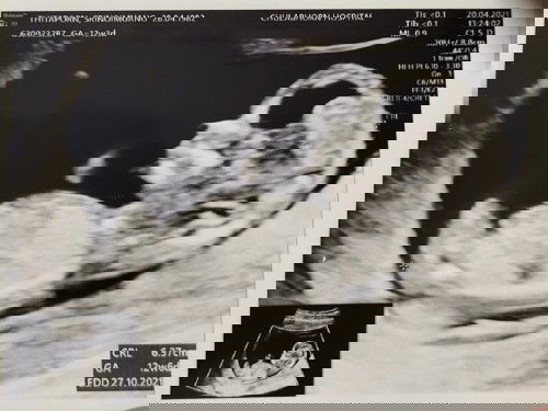 สัปดาห์ที่ 12 กับเจ้าตัวน้อย 😉