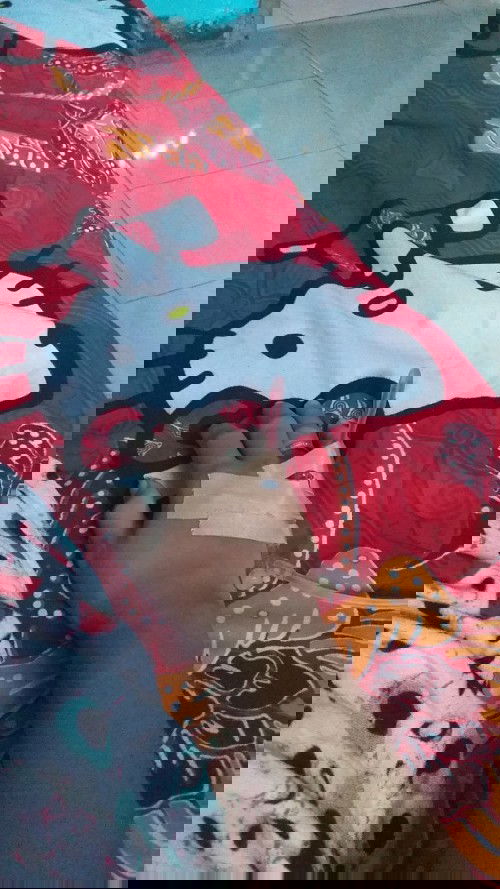 Doain ya bund, sakit maag sama ISK