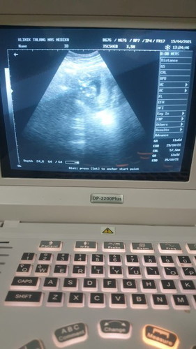 Alhamdulillah sehat selalu syg di dalem perut itunganUSG yg di komputer 12w tapi itungan sya udh 14w