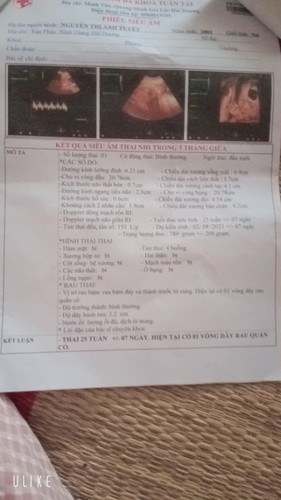 Bầu 25 tuần mà bé bị dây rốn quấn cổ 1 vòng có làm sao không các mom !!!? Em lo quá 😑😑