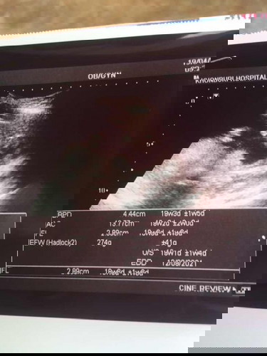 ผมเป็นผู้ชายครับ 20w 1d 👶🏻