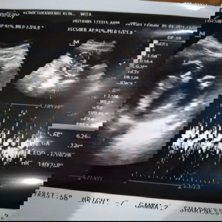 Pertama kali post ❤