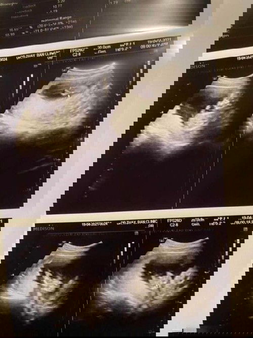 15W3d ทราบเพศละค้าบบบบ