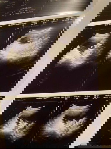 15W3d ทราบเพศละค้าบบบบ