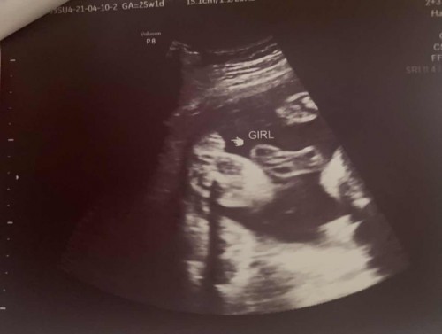 Baby Gender