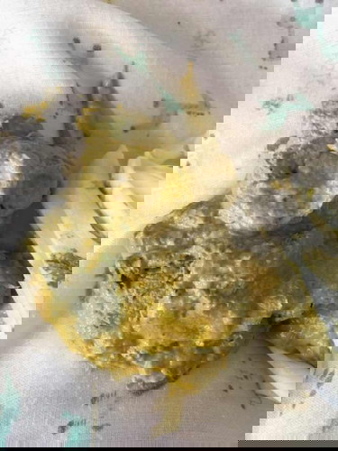 การขับถ่ายปกติหรือผิดปกติ?