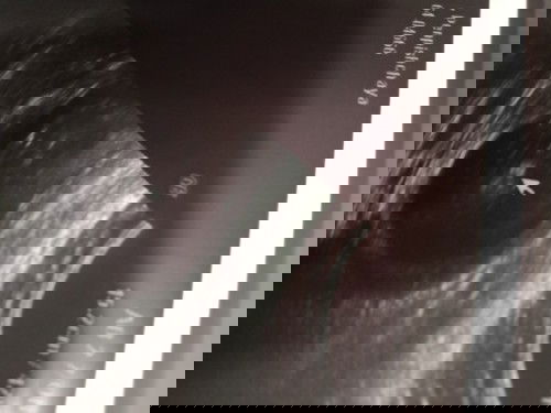 ถามแม่ๆที่มีประสบการณ์หน่อยคะ แบบนี้หญิงหรือชายคะเเต่คุณหมอบอกว่าน่าจะชาย #ขอบคุณสำหรับคำตอบคะ😊😊😊