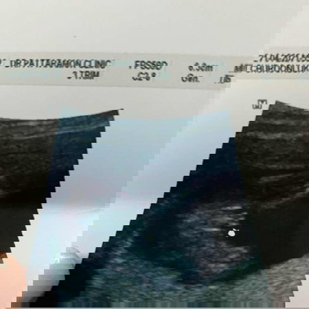 แม่ๆช่วยดูหน่อยค่ะจู๋หรือจิ๋ม🤣🤣