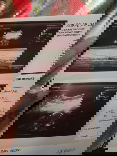Ultrasound again