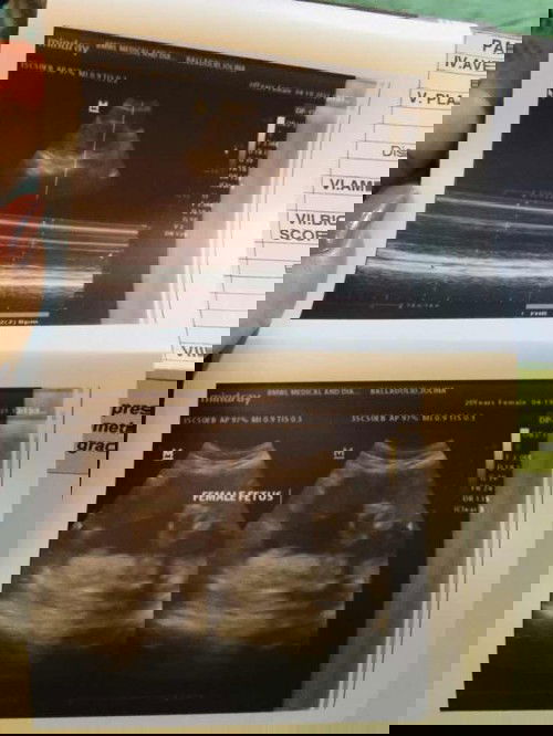 Baby girl name suggestions