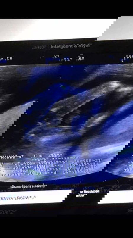 ผู้หญิงจริงๆมั้ยน้อออ