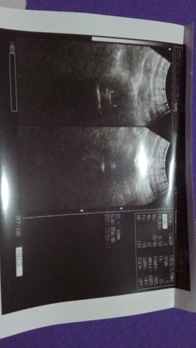 Ingin tahu hasil USG