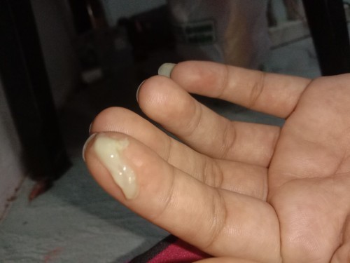 ท้อง36สัปดาห์