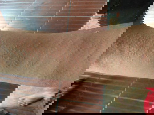 Alergi gatal saat hamil 15 minggu
*infoobat