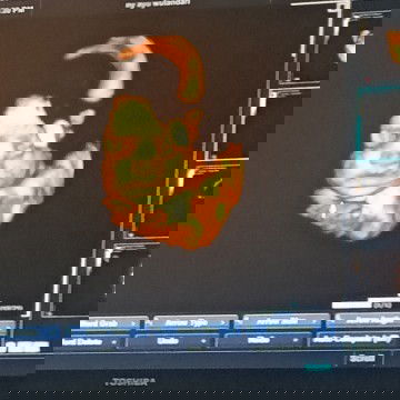 Hpl juli udah ngerasain apa aja nih bundd??