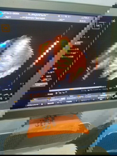 Usia 33wk..Bb 2.5 smoga baik²saja tanpa halangan sampai hari H sehat ibu dan bayi nya ..