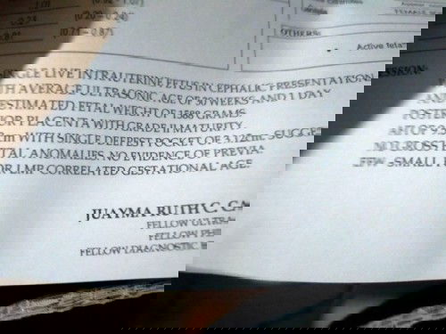 Small for her gestational age