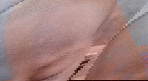 Bercak putih pada kening bayi