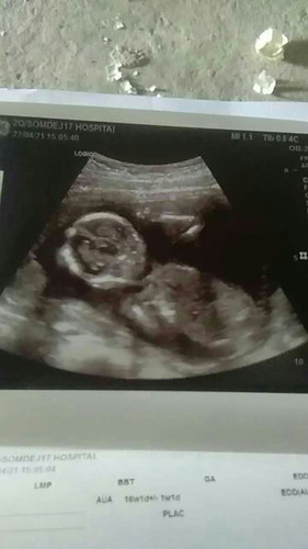 บ้านนี้ 16 week แล้วค้ะ