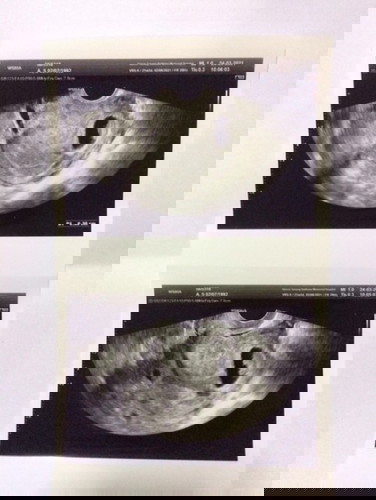 แม่ๆที่เคยเจอเคสแบบนี้ช่วยตอบแม่ทีค่ะ