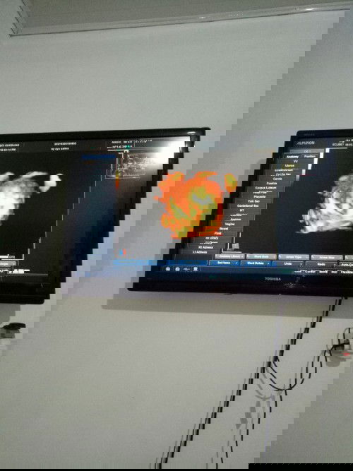 Assalamu'alaikum bund mimin mau minta saran untuk nama bayi laki" Dari ayu dan febriansyah apa y bu?