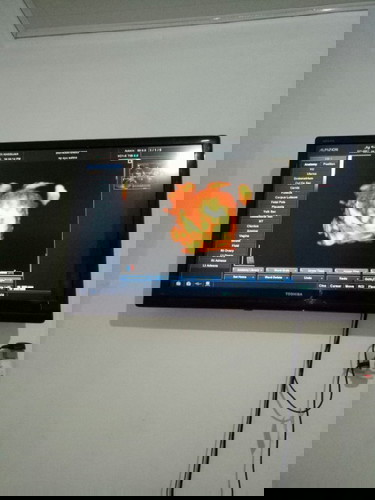 Assalamu'alaikum bund mimin mau minta saran untuk nama bayi laki" Dari ayu dan febriansyah apa y bu?