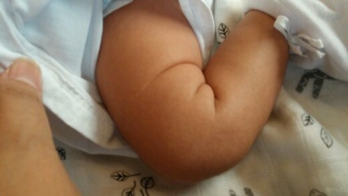 5 weeks old - skin rashes