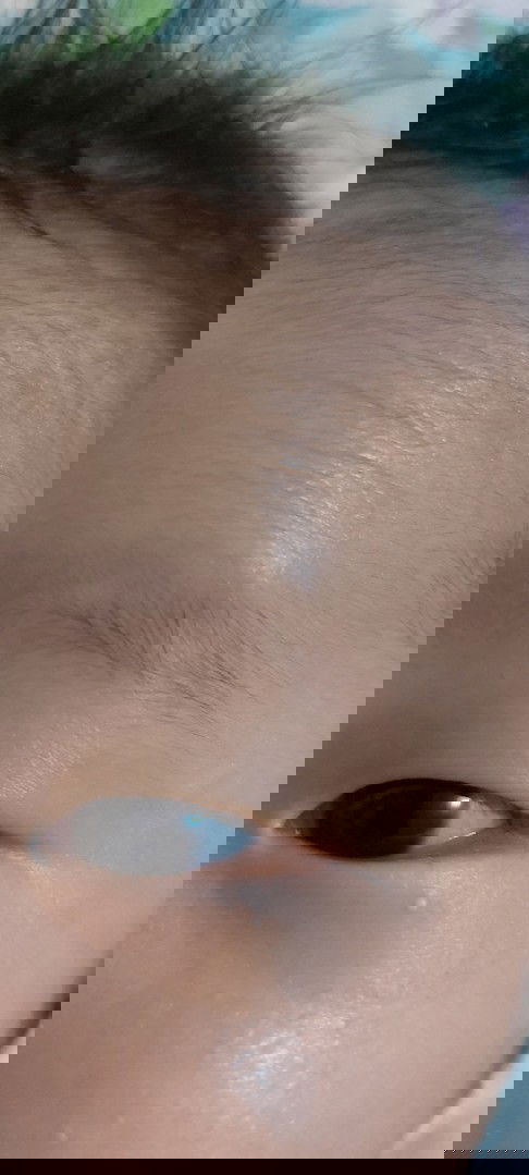 Bintik putih pada bayi