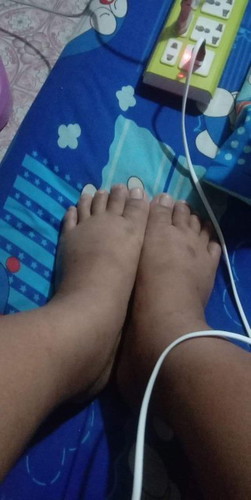 แบบนี้เป็นครรภ์เป็นพิษมั้ยค่ะ