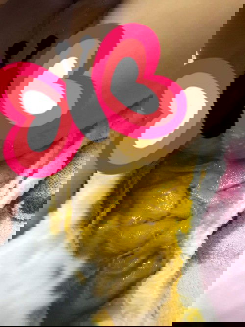 เด็ก29วัน ถ่ายเหลว