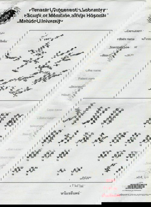 แม่ท้อง ต้อน 42 ต้องเจาะน้ำคร่ำ