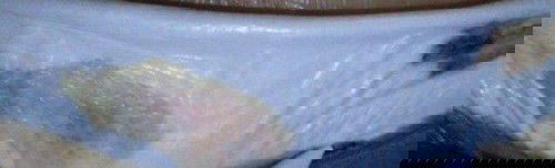 Hamil jarak dekat riwayat SC